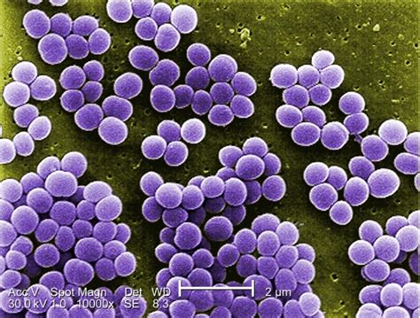 Staphylococcus Concise Medical Knowledge