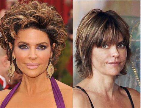 How Much Plastic Surgery Has Lisa Rinna Had Over The