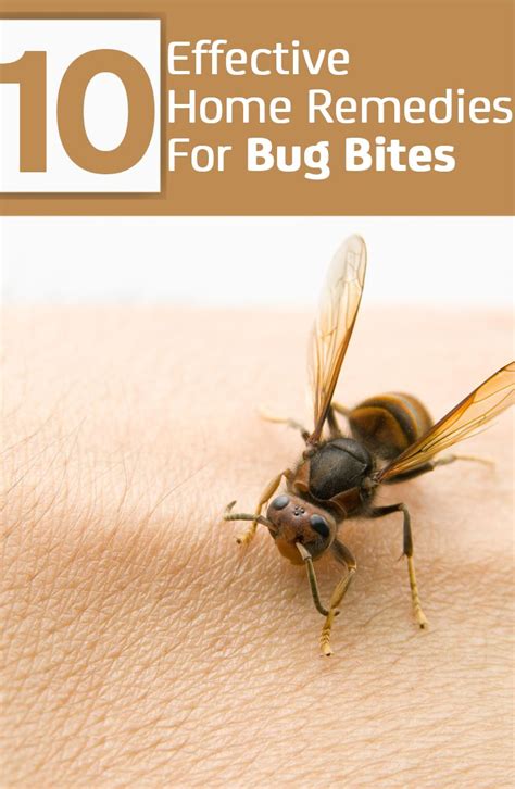 7 Simple Home Remedies To Get Rid Of Bug Bites And Stings Bug Bites