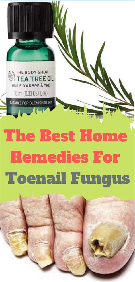 How To Use Tea Tree Oil For Toenail Fungus Let Us Look At The Step By