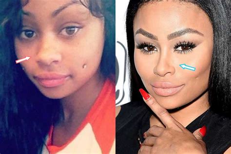 Her popularity erupted when the hip hop/ rap singer drake dropped her name in the song she attended henry e. Blac Chyna Plastic Surgery: Nose Job,Boob Job,Bum Implants
