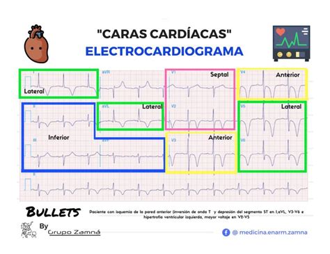 Caras Cardiacas ECG UDocz