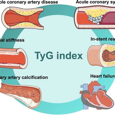 The Useful History Of Triglyceride Glucose Index Tyg Tyg