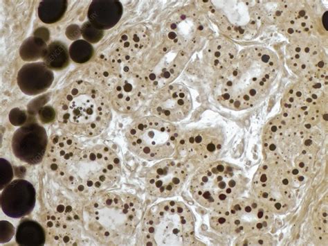 Lactating Human Mammary Gland Light Micrograph Stock Image C055