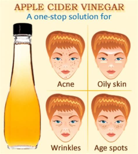 Apple Cider Vinegar Treatments For Acne Free Skin Bellatory