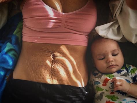 21 Awesome Photos That Show How Different Postpartum Bodies Can Look Self