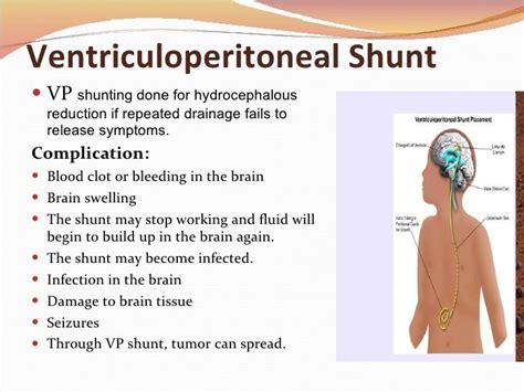 Diagnosis Treatment And Management Of Medulloblastoma