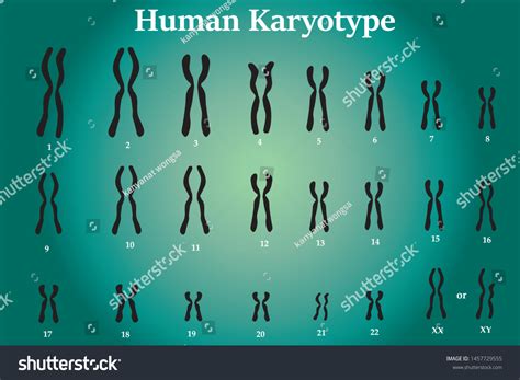 Karyotype Normal Human Chromosome Illustration Vector Stock Vector