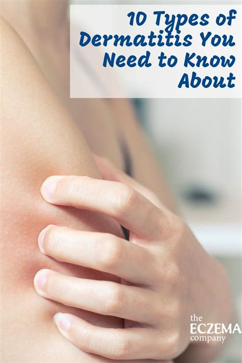 10 Types Of Dermatitis You Need To Know About Dermatitis Skin