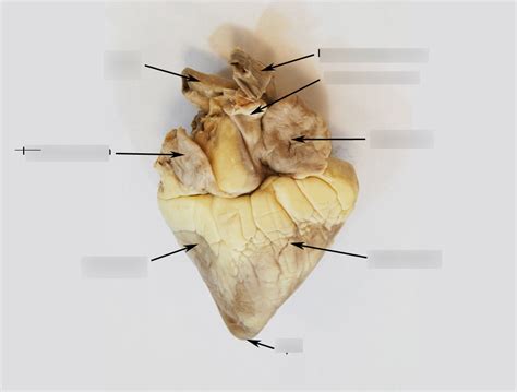 Lab Posterior Sheep Heart Diagram Quizlet