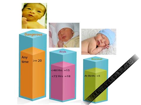Jaundice Levels In Babies Babbies Ywu