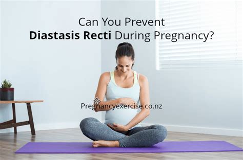 They bulged and there was a groove between them. Can you Prevent Diastasis Recti During Pregnancy ...