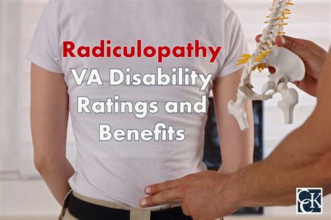 Radiculopathy Va Disability Ratings And Benefits Cck Law
