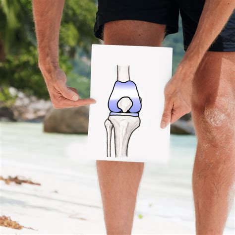 Important Exercises To Do Before A Knee Replacement The Senior Centered Pt