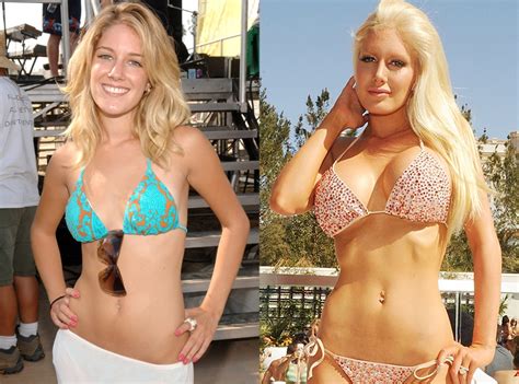 Heidi Montag From Celebs Whove Admitted To Getting Plastic Surgery E News