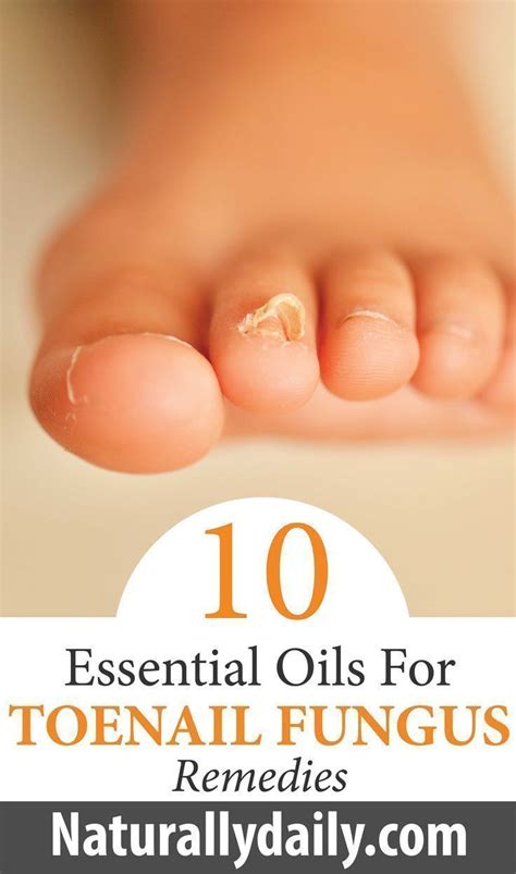 10 Best Essential Oils For Toenail Fungus Remedies Naturallydaily In