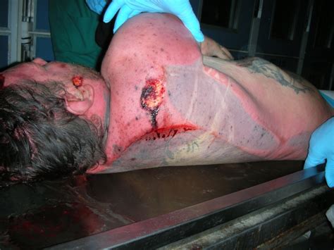 Federico perna ретвитнул(а) trash italiano. Federico Perna morto in carcere: le foto dell'autopsia ...