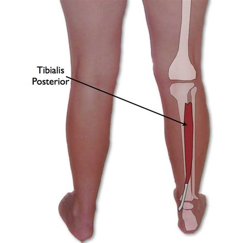 Tibialis Posterior Trigger Point Runner S Achilles Tendonitis TriggerPointTherapist