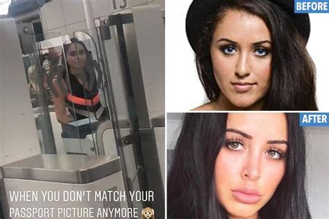 Marnie Simpson Blocked At Passport Control After Having So Much Surgery Her Face Doesn’t Match