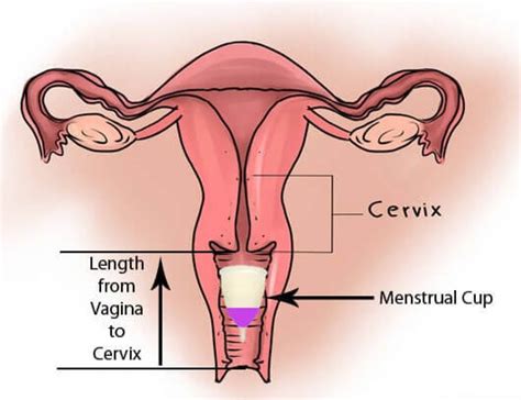 How To Choose Best Menstrual Cup For A Low Cervix And High Cervix