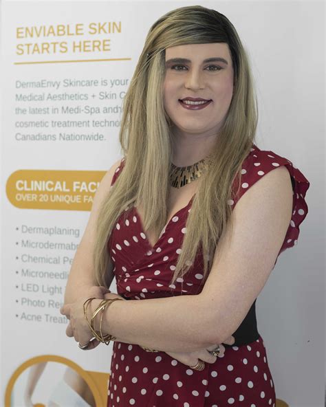 Brookes Laser Hair Removal Journey A Transgender Support Program