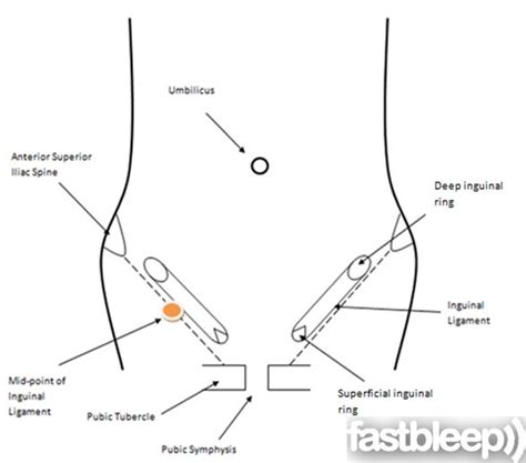 Pin By Stelios Daskalogiannis On Hernias Groin Diagram Chart Line