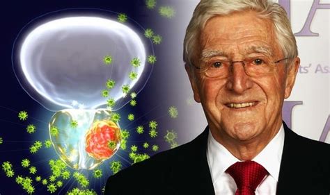 Michael Parkinson Health Prostate Cancer Diagnosis Came As A Great Shock Symptoms Express