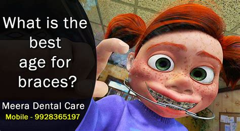 What Is The Best Age For Braces Meera Dental Care