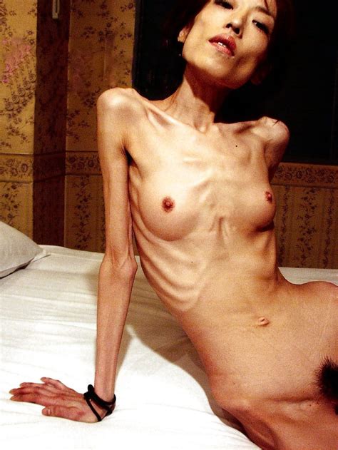 Naked Anorexic Photos