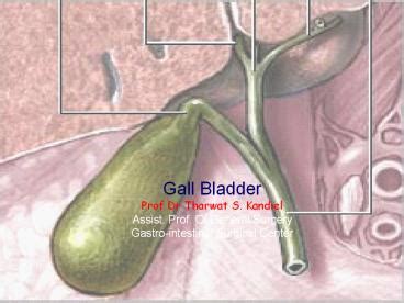 PPT Gall Bladder PowerPoint Presentation Free To Download Id Ba ZDc N