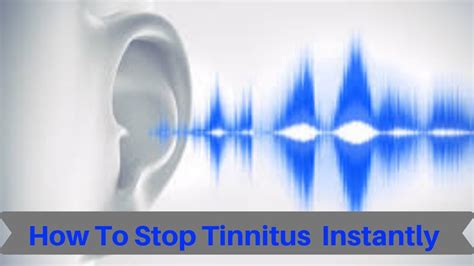How To Stop Tinnitus Instantly How To Get Rid Of Tinnitus Naturally