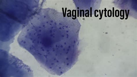 Vaginal Cytology Interpretation Canine Estrus Cycle Youtube Hot Sex