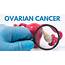 Ovarian Cancer Why Early Diagnosis Is So Important  Intrust Care