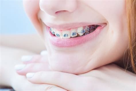 Tips For Choosing An Orthodontist Advanced Orthodontic Care