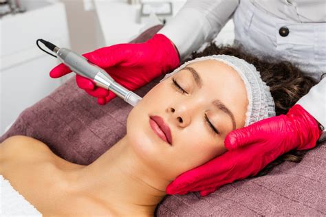 Microneedling What Is It