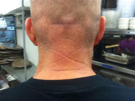 The Crease On My Co Workers Neck Forms A Perfect X Mildlyinteresting