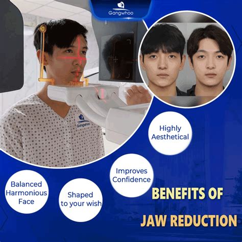 Jaw Reduction 5 Reasons Why It Is Right For You