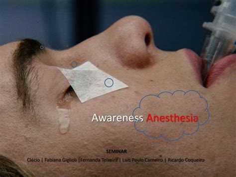 Awareness Anesthesia Ppt