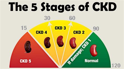 Stages Of Chronic Kidney Disease Chart