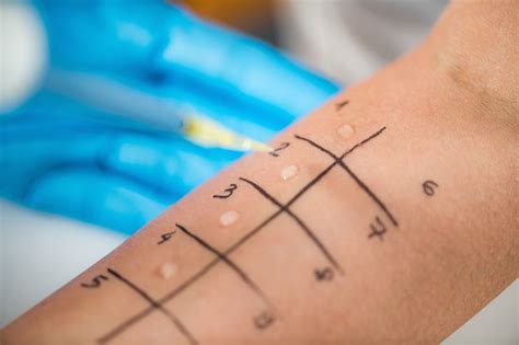 When Should I Consider Getting An Allergy Test Tlc Medical