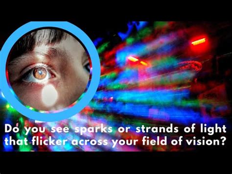 What Causes Flashing Lights In Eyes At Night