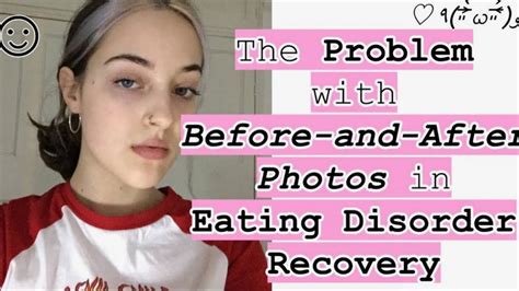 The Problem With Before And After Photos In Eating Disorder Recovery