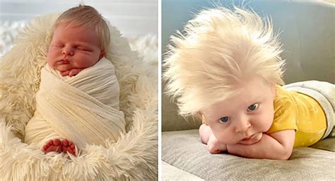 Baby Born With Full Head Of Blond Hair Makes Curious Everyoneamazing