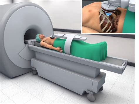 New Mri Guided Focused Ultrasound Surgical System Accommodates Organ