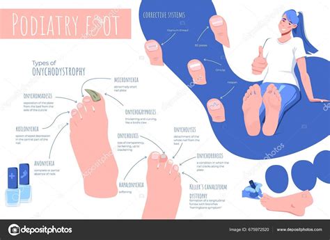 Podiatry Foot Disease Flat Infographic Composition Human Feet Images