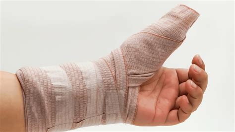healing a broken finger diagnosis and recovery guide medical news times