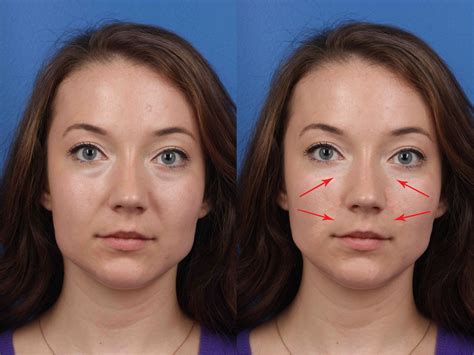 I Had My Face Morphed By A Plastic Surgeon And Was Shocked By The