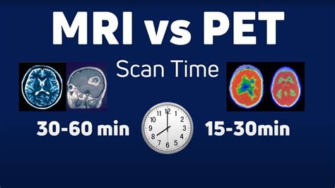 Mri Vs Pet Scan Radiation Cancer And Key Differences Youtube