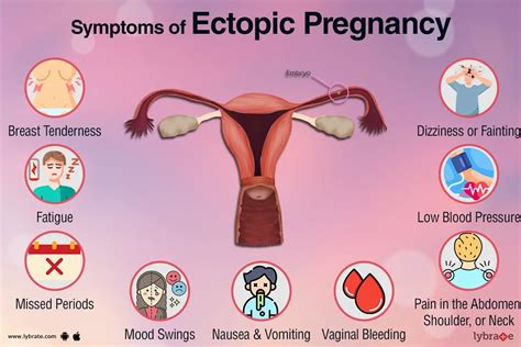Ectopic Pregnancy Complications Risks And Precautions Ask The Nurse