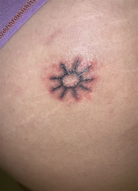A foul odor from a tattoo is an indication that it is infected. Everything about infected tattoo - Causes, Treatments and ...